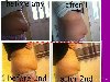 Inch loss wraps  Picture