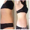 Ultimate Body Applicator (body w... Picture