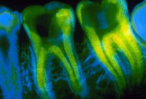 Cavities and Treatme offer Fitness, Dance & Health