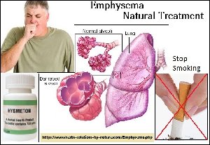 Natural Treatment for Emphysema Picture