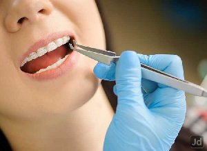 Dental Specialist in Trivandrum offer Services Abroad
