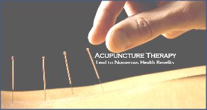 London Acupuncture Therapy  Picture